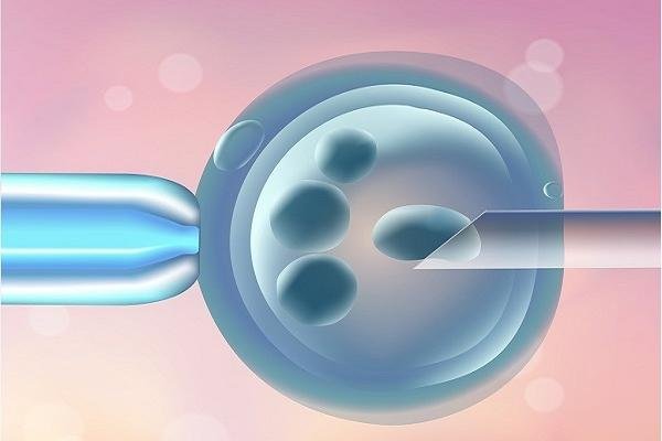 吉尔吉斯斯坦试管婴儿如何帮助男性不育症患者实现生育？