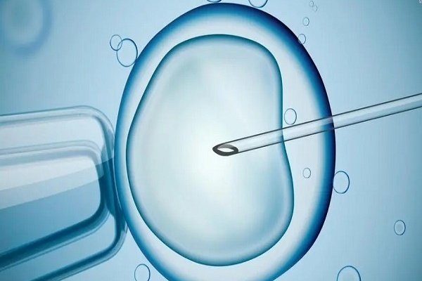 卵胞浆内单精子注射（ICSI）在吉尔吉斯斯坦试管中的成功率如何？